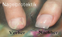 nagelrep